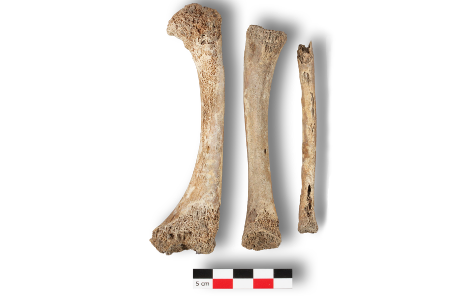 Les os de la jambe droite (Fémur, tibia et péroné)